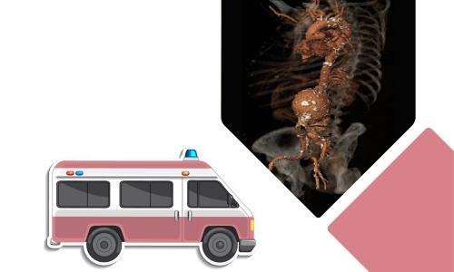 event list item image
